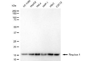 Western blotting analysis using ring-box 1 antibody (ABIN7800253). (RBX1 Antikörper)