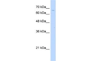 WB Suggested Anti-TKTL2 Antibody Titration:  2. (TKTL2 Antikörper  (C-Term))