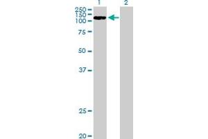 Western Blot analysis of CCDC66 expression in transfected 293T cell line by CCDC66 MaxPab polyclonal antibody. (CCDC66 Antikörper  (AA 1-831))