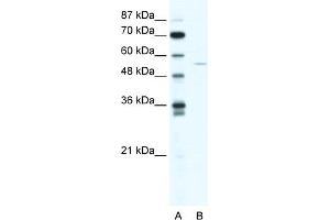 WB Suggested Anti-ZNF289 Antibody Titration:  1.