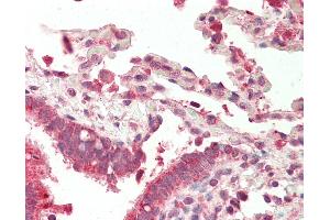 Immunohistochemistry (IHC) image for anti-Nuclear Factor of Activated T-Cells, Cytoplasmic, Calcineurin-Dependent 4 (NFATC4) (N-Term) antibody (ABIN6754931)