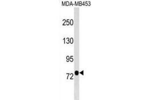Western Blotting (WB) image for anti-Chromosome 9 Open Reading Frame 3 (C9orf3) antibody (ABIN2999510)