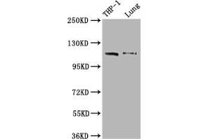 Western Blot Positive WB detected in: THP-1 whole cell lysate, Mouse lung tissue All lanes: MDA5 antibody at 1:2000 Secondary Goat polyclonal to rabbit IgG at 1/50000 dilution Predicted band size: 117, 26 kDa Observed band size: 117 kDa (Rekombinanter IFIH1 Antikörper)