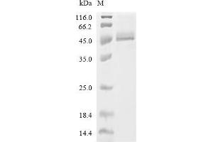 N-Myc Downstream Regulated 1 (NDRG1) (AA 2-394), (full length) protein (His tag)