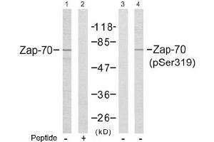 Image no. 2 for anti-zeta-Chain (TCR) Associated Protein Kinase 70kDa (ZAP70) (Tyr319) antibody (ABIN197385) (ZAP70 Antikörper  (Tyr319))