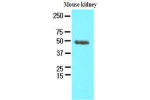 Western Blotting (WB) image for anti-Proteasome (Prosome, Macropain) 26S Subunit, Non-ATPase, 11 (PSMD11) (AA 1-422), (N-Term) antibody (ABIN371887) (PSMD11 Antikörper  (N-Term))
