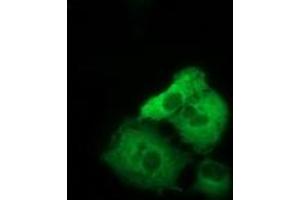 Anti-TACC3 mouse monoclonal antibody (ABIN2453830) immunofluorescent staining of COS7 cells transiently transfected by pCMV6-ENTRY TACC3 (RC210754). (TACC3 Antikörper)