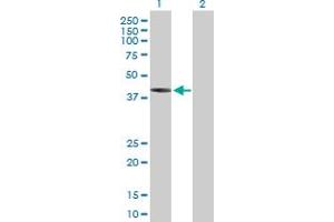 Western Blot analysis of IVD expression in transfected 293T cell line by IVD MaxPab polyclonal antibody. (IVD Antikörper  (AA 1-423))
