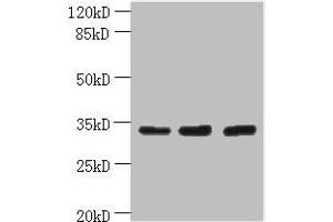 Western blot All lanes: OTUD6B antibody at 4 μg/mL Lane 1: PC-3 whole cell lysate Lane 2: 293T whole cell lysate Lane 3: MDA-MB-231 whole cell lysate Secondary Goat polyclonal to rabbit IgG at 1/10000 dilution Predicted band size: 34, 22 kDa Observed band size: 34 kDa (OTUD6B Antikörper  (AA 1-293))