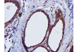Immunohistochemical staining of paraffin-embedded Human breast tissue using anti-EPN2 mouse monoclonal antibody. (Epsin 2 Antikörper)