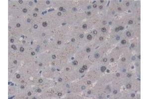 Detection of UNG in Human Liver Tissue using Polyclonal Antibody to Uracil DNA Glycosylase (UNG)