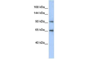 WB Suggested Anti-CCDC52 Antibody Titration: 0. (SPICE1 Antikörper  (Middle Region))