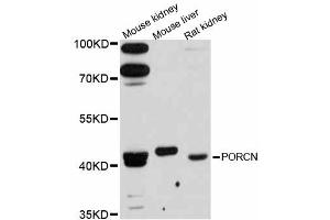 Western blot analysis of extracts of various cell lines, using PORCN antibody. (PORCN Antikörper)