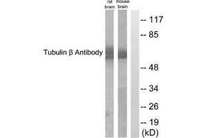 Western blot analysis of extracts from rat brain and mouse brain cells, using Tubulin beta antibody. (TUBB Antikörper  (C-Term))