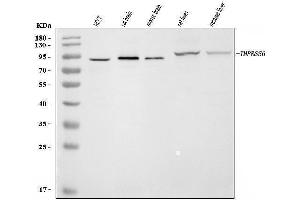 Western blot analysis of Matriptase 2/TMPRSS6 using anti-Matriptase 2/TMPRSS6 antibody (ABIN7599541).