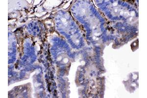 Immunohistochemistry (IHC) image for anti-Fibroblast Growth Factor 1 (Acidic) (FGF1) (AA 16-155) antibody (ABIN4886581)