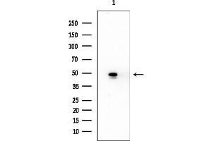 anti-Trk-Fused Gene (TFG) antibody