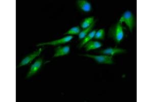 Immunofluorescence staining of Hela cells with ABIN7164423 at 1:100, counter-stained with DAPI. (HECTD2 Antikörper  (AA 674-776))