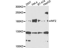 Western blot analysis of extracts of various cells, using INF2 antibody. (INF2 Antikörper)