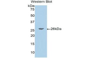 Western Blotting (WB) image for anti-Jagged 1 (JAG1) (AA 33-250) antibody (ABIN1175042)