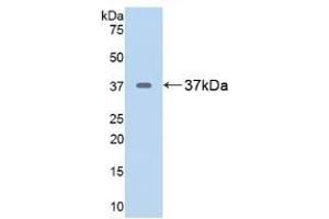 Detection of Recombinant ARG, Rat using Polyclonal Antibody to Arginase (ARG) (ARG Antikörper  (AA 1-323))