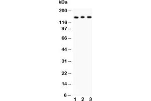 Western blot testing of Insulin Receptor antibody and Lane 1:  rat kidney;  2: PANC;  3: HeLa (Insulin Receptor Antikörper  (AA 1353-1372))
