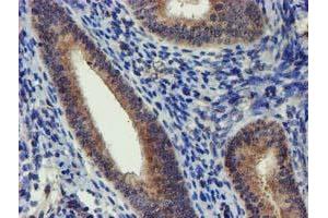 Immunohistochemical staining of paraffin-embedded Human endometrium tissue using anti-DCLRE1B mouse monoclonal antibody. (DCLRE1B Antikörper  (AA 1-280))
