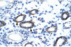 Human kidney; GTF2F2 antibody - C-terminal region in Human kidney cells using Immunohistochemistry (GTF2F2 Antikörper  (C-Term))