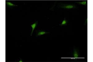 Immunofluorescence of monoclonal antibody to DEAF1 on HeLa cell.