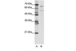 Image no. 1 for anti-TAF6-Like RNA Polymerase II, P300/CBP-Associated Factor (PCAF)-Associated Factor, 65kDa (TAF6L) (N-Term) antibody (ABIN203282) (TAF6L Antikörper  (N-Term))