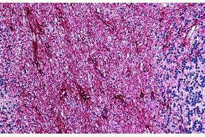 Human Brain, Cerebellum: Formalin-Fixed, Paraffin-Embedded (FFPE) (GFAP Antikörper)