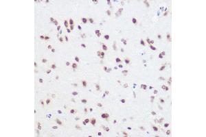 Immunohistochemistry (IHC) image for anti-Squamous Cell Carcinoma Antigen Recognized By T Cells 3 (SART3) (AA 664-963) antibody (ABIN6147392)