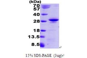 SDS-PAGE (SDS) image for R-Ras (AA 1-215) protein (His tag) (ABIN667781)