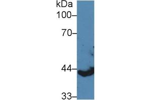 Western blot analysis of Pig Spleen lysate, using Human KRT13 Antibody (5 µg/ml) and HRP-conjugated Goat Anti-Rabbit antibody ( (Cytokeratin 13 Antikörper  (AA 104-403))
