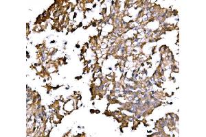 IHC analysis of IRBIT/AHCYL1 using anti-IRBIT/AHCYL1 antibody (ABIN7600030).