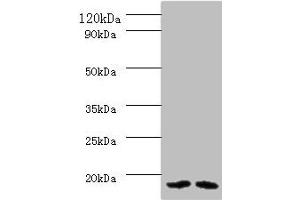 Western blot All lanes: PAM16 antibody at 2 μg/mL Lane 1: HL60 whole cell lysate Lane 2: HepG2 whole cell lysate Secondary Goat polyclonal to rabbit IgG at 1/10000 dilution Predicted band size: 14 kDa Observed band size: 14 kDa (MAGMAS Antikörper  (AA 1-125))