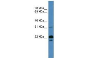 Image no. 1 for anti-Brain Abundant, Membrane Attached Signal Protein 1 (BASP1) (AA 51-100) antibody (ABIN6746712) (BASP1 Antikörper  (AA 51-100))