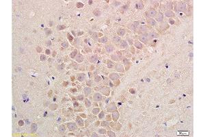 Formalin-fixed and paraffin embedded rat liver tissue labeled with Rabbit Anti-Substance P Polyclonal Antibodyat 1:200 followed by conjugation to the secondary antibody and DAB staining. (Substance P Antikörper  (AA 58-68))