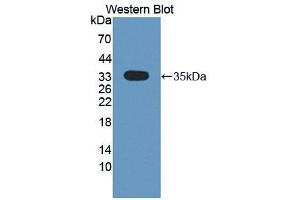 Western blot analysis of the recombinant protein. (CMTM1 Antikörper  (AA 1-286))