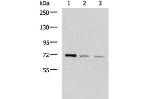Western blot analysis of K562 HepG2 and Jurkat cell lysates using FOXK1 Polyclonal Antibody at dilution of 1:400 (Foxk1 Antikörper)
