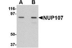 Western Blotting (WB) image for anti-Nucleoporin 107kDa (NUP107) (C-Term) antibody (ABIN1030552)