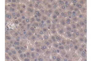 Used in DAB staining on fromalin fixed paraffin- embedded kidney tissue (TNFSF14 Antikörper  (AA 58-239))