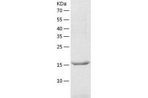 Western Blotting (WB) image for Josephin Domain Containing 1 (JOSD1) (AA 1-202) protein (His tag) (ABIN7123646) (JOSD1 Protein (AA 1-202) (His tag))