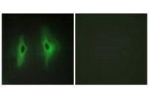 Immunofluorescence analysis of HeLa cells, using DGKH antibody. (DGKH Antikörper)