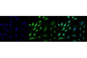 Immunocytochemistry/Immunofluorescence analysis using Mouse Anti-Ubiquitin Monoclonal Antibody, Clone FK1 (ABIN5024470). (Ubiquitin Antikörper  (FITC))