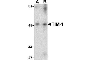 Western Blotting (WB) image for anti-Hepatitis A Virus Cellular Receptor 1 (HAVCR1) (Middle Region) antibody (ABIN1031124) (HAVCR1 Antikörper  (Middle Region))