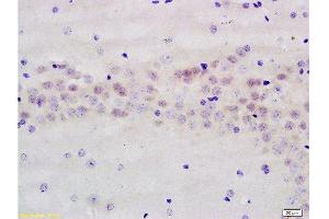 Formalin-fixed and paraffin embedded rat brain labeled with Anti-AMPK beta 1 Polyclonal Antibody, Unconjugated  at 1:200 followed by conjugation to the secondary antibody and DAB staining. (PRKAB1 Antikörper  (AA 201-270))