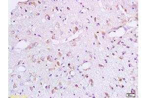Formalin-fixed and paraffin embedded rat brain labeled with Anti-BCAT1 Polyclonal Antibody, Unconjugated (ABIN718856) at 1:200 followed by conjugation to the secondary antibody and DAB staining. (BCAT1 Antikörper  (AA 321-386))