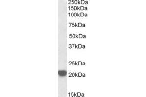 Western Blotting (WB) image for anti-Ras-Related C3 Botulinum Toxin Substrate 2 (Rho Family, Small GTP Binding Protein Rac2) (RAC2) (C-Term) antibody (ABIN2465289) (RAC2 Antikörper  (C-Term))