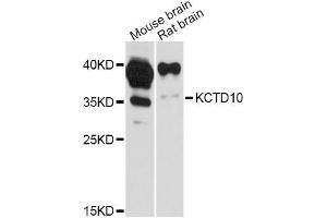 Western blot analysis of extracts of various cell lines, using KCTD10 Antibody (ABIN5998054) at 1:3000 dilution. (KCTD10 Antikörper)